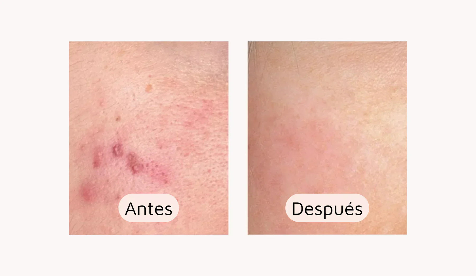 "Lo más sorprendente fue la rapidez con la que noté los cambios"